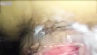 真实叔嫂乱伦 小叔子照顾生病的亲嫂子