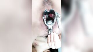 羞涩小仙女全程露脸丝袜高跟来看看逼逼的淫水多不多，扩阴器撑开骚穴跳蛋塞进去自慰骚穴，啤酒瓶插逼呻吟