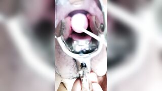 羞涩小仙女全程露脸丝袜高跟来看看逼逼的淫水多不多，扩阴器撑开骚穴跳蛋塞进去自慰骚穴，啤酒瓶插逼呻吟
